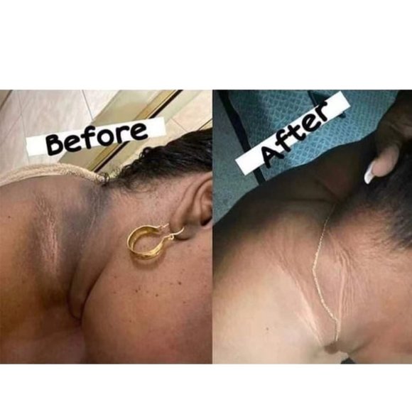 Dark Skin Bleach Body Bleaching Cream Max Strength Whitening Lightening - Picture 8 of 12